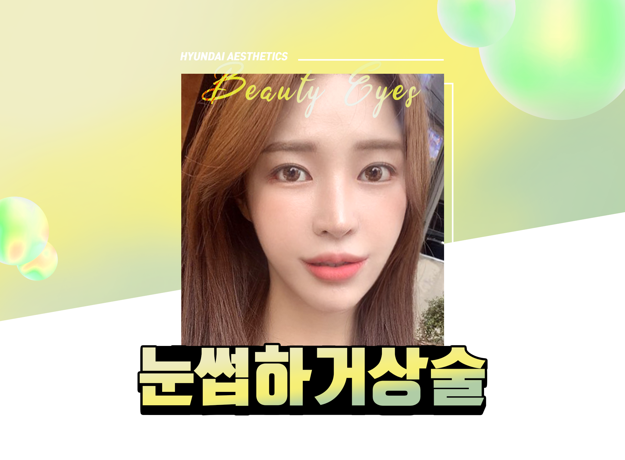 Pengencangan alis Hyundai Aesthetics — HYUNDAI AESTHETICS Beauty Eyes, foto model pengencangan bawah alis