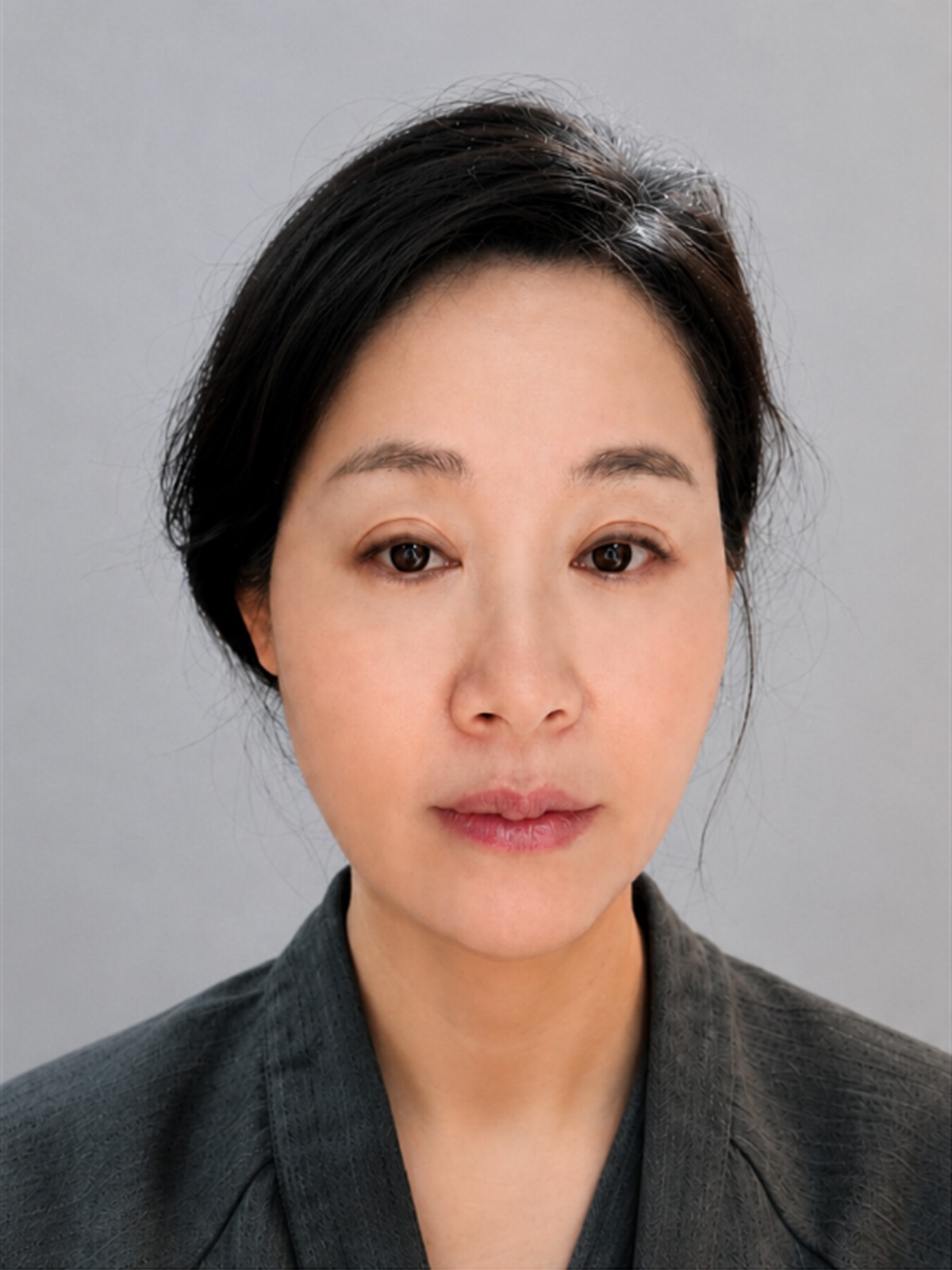 Facelift REAL SMAS after