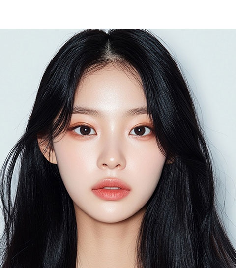 Foto contoh hasil operasi kelopak mata ganda dengan sayatan 1