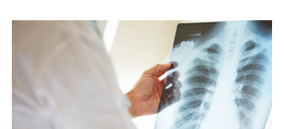 Pemeriksaan X-Ray
