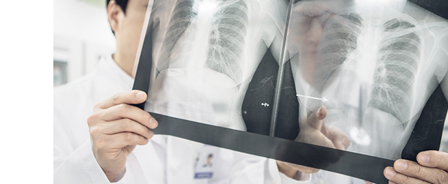 Persiapan anestesi yang aman melalui pemeriksaan praoperasi (X-Ray)