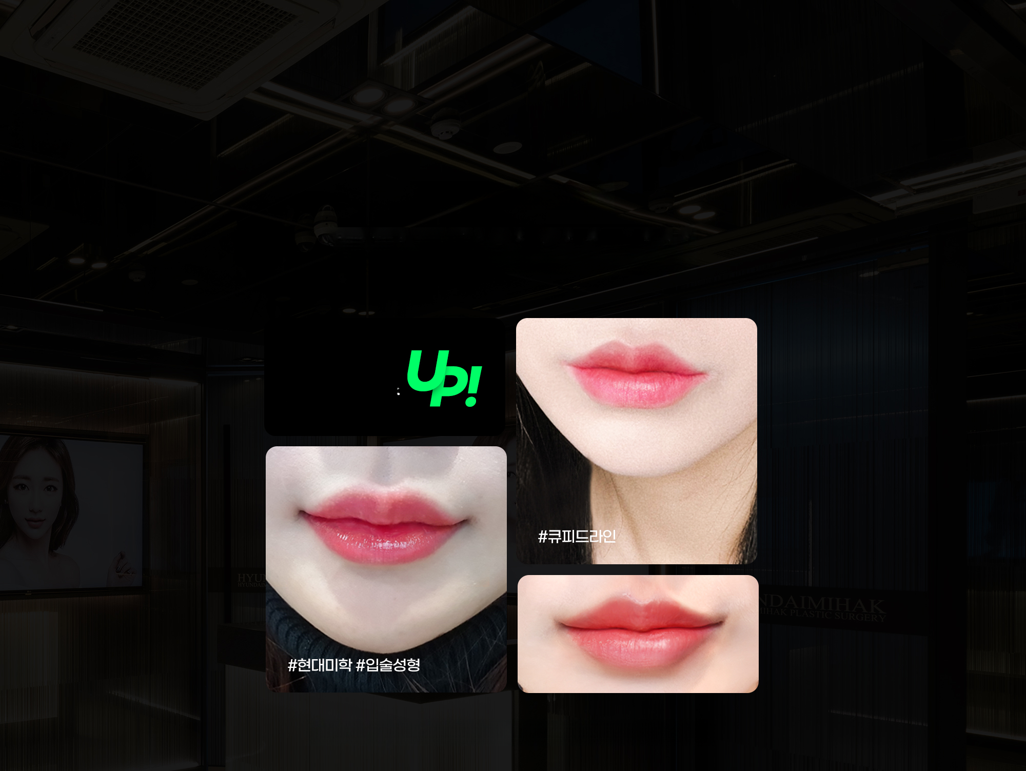 Foto bibir sebelum dan sesudah operasi bibir Cupid Line