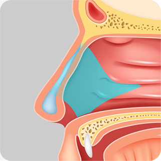 Ilustrasi lokasi tulang rawan septum