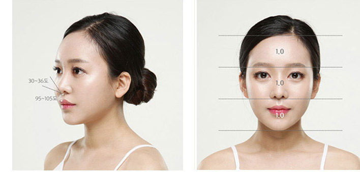 Foto wajah tampak samping dan depan yang menunjukkan kriteria bentuk hidung ideal (sudut dan proporsi ditandai)