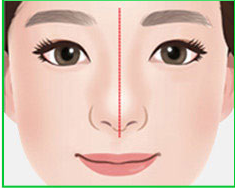 Ilustrasi bentuk hidung normal