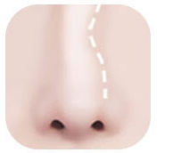 Ilustrasi hidung dengan batang hidung bengkok
